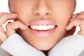 Opalescence Bleaching 16% Zahnaufhellung weiße Zähne